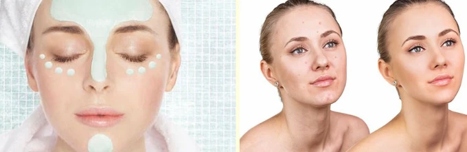 sodium ascorbyl phosphate for skin sodium ascorbyl phosphate for skin